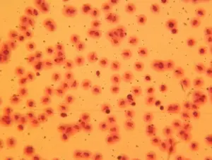 Teste de Fragmentação do DNA espermático